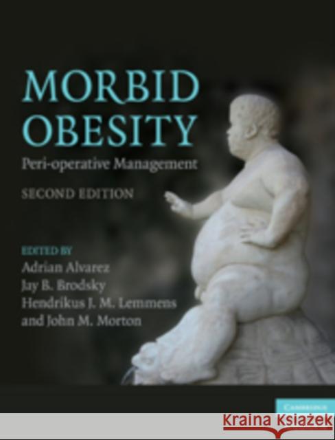 Morbid Obesity: Peri-Operative Management