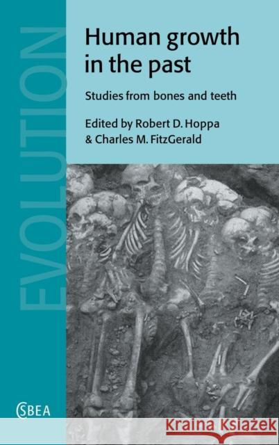 Human Growth in the Past: Studies from Bones and Teeth