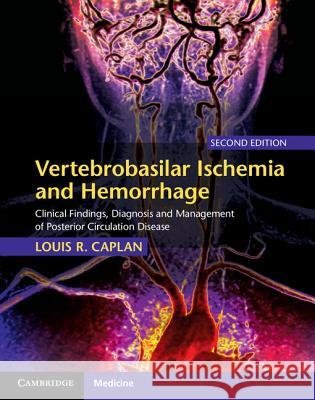 Vertebrobasilar Ischemia and Hemorrhage: Clinical Findings, Diagnosis and Management of Posterior Circulation Disease