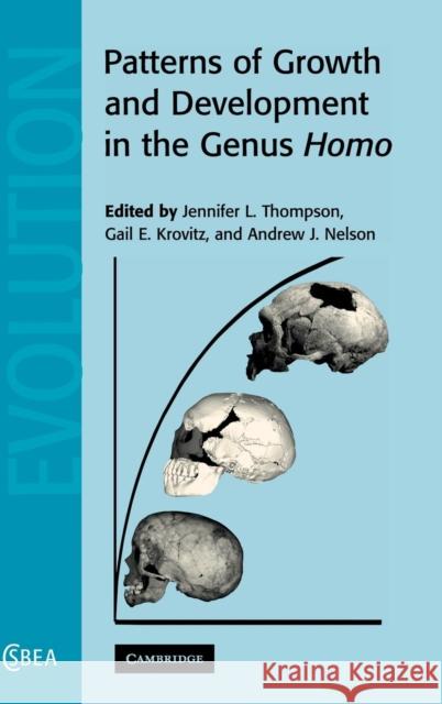 Patterns of Growth and Development in the Genus Homo