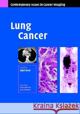 Lung Cancer