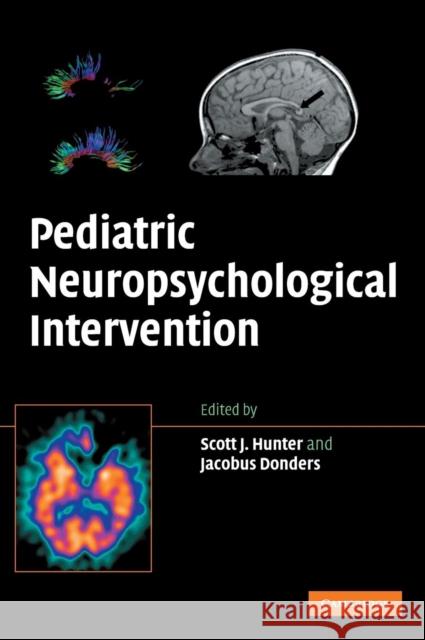 Pediatric Neuropsychological Intervention: A Critical Review of Science & Practice