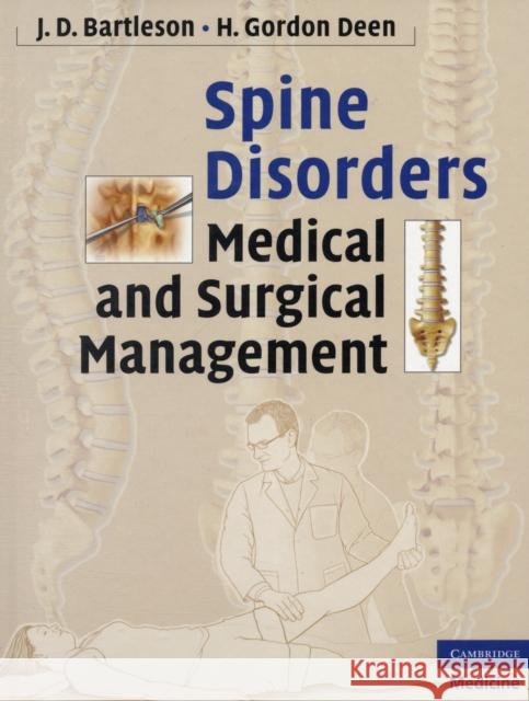 Spine Disorders: Medical and Surgical Management