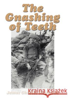 The Gnashing of Teeth