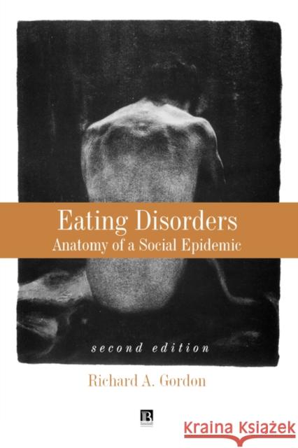 Eating Disorders: Anatomy of a Social Epidemic