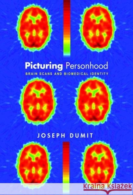 Picturing Personhood: Brain Scans and Biomedical Identity