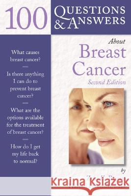 100 Questions and Answers About Breast Cancer