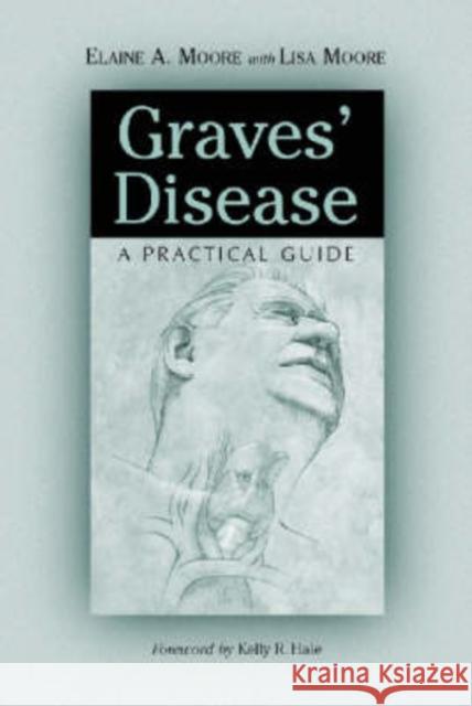 Graves' Disease: A Practical Guide