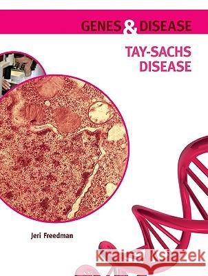 Tay-Sachs Disease