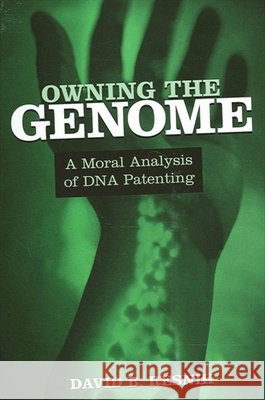 Owning the Genome: A Moral Analysis of DNA Patenting
