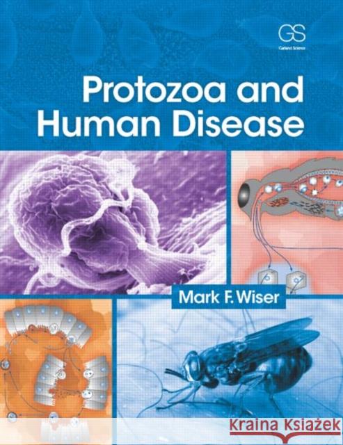 Protozoa and Human Disease