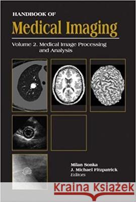 Handbook Of Medical Imaging, Volume 2: Medical Image Processing And Analysis