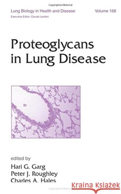 Proteoglycans in Lung Disease