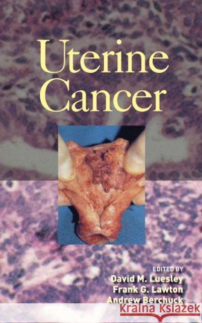 Uterine Cancer