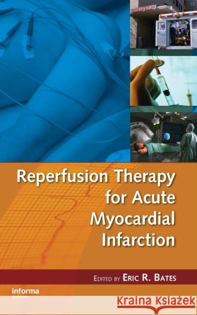 Reperfusion Therapy for Acute Myocardial Infarction