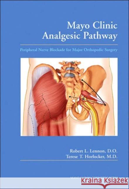 Mayo Clinic Analgesic Pathway: Peripheral Nerve Blockade for Major Orthopedic Surgery