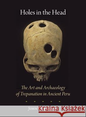 Holes in the Head: The Art and Archaeology of Trepanation in Ancient Peru