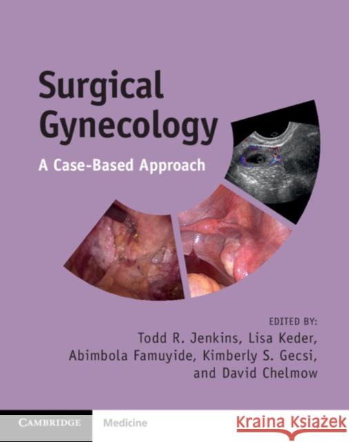 Surgical Gynecology: A Case-Based Approach