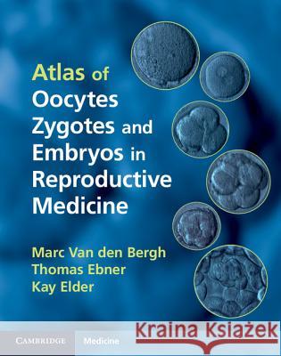 atlas of oocytes, zygotes and embryos in reproductive medicine hardback 