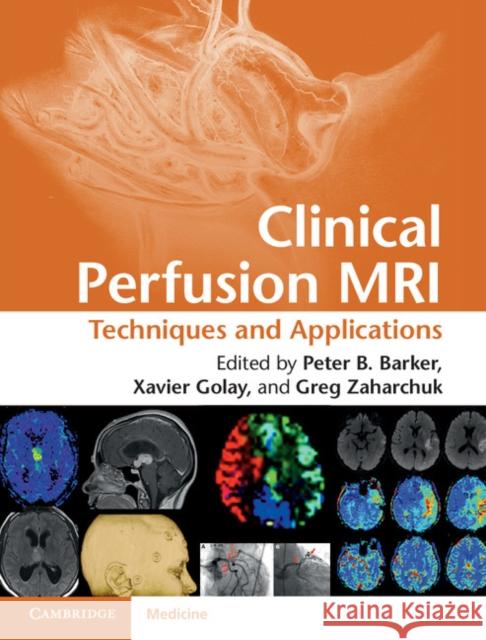 Clinical Perfusion MRI: Techniques and Applications