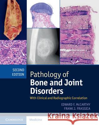 Pathology of Bone and Joint Disorders Print and Online Bundle: With Clinical and Radiographic Correlation