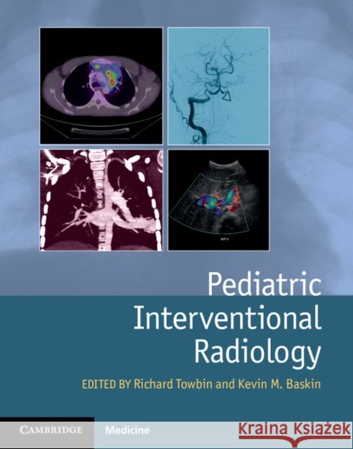Pediatric Interventional Radiology
