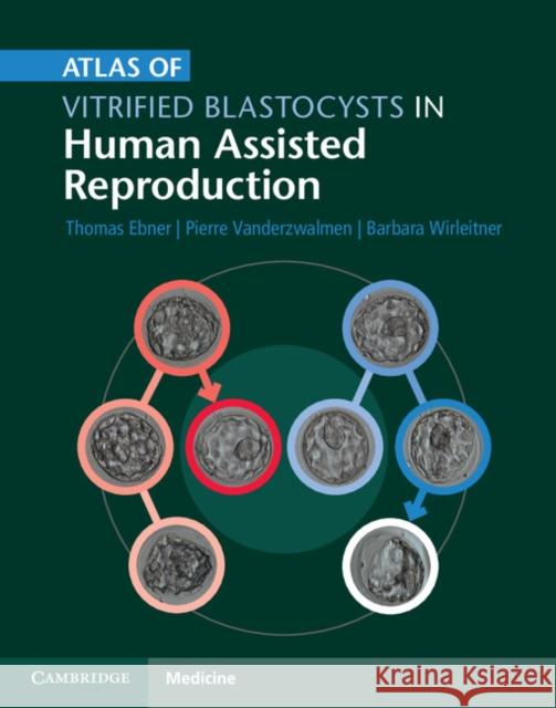 Atlas of Vitrified Blastocysts in Human Assisted Reproduction