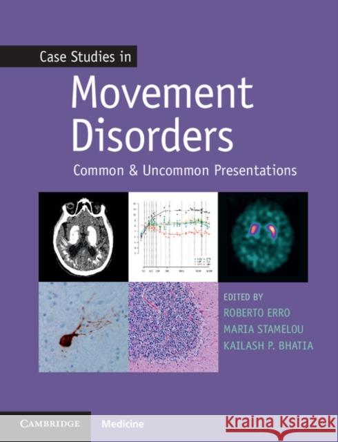 Case Studies in Movement Disorders: Common and Uncommon Presentations