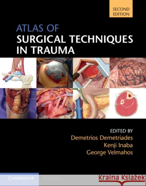 Atlas of Surgical Techniques in Trauma