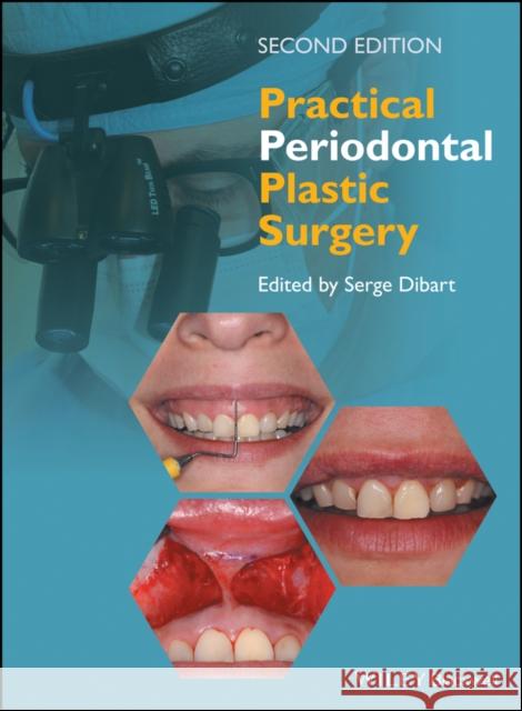 Practical Periodontal Plastic Surgery