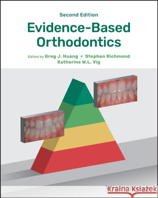 Evidence-Based Orthodontics