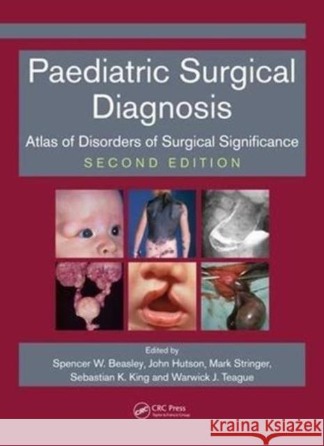 Paediatric Surgical Diagnosis: Atlas of Disorders of Surgical Significance, Second Edition