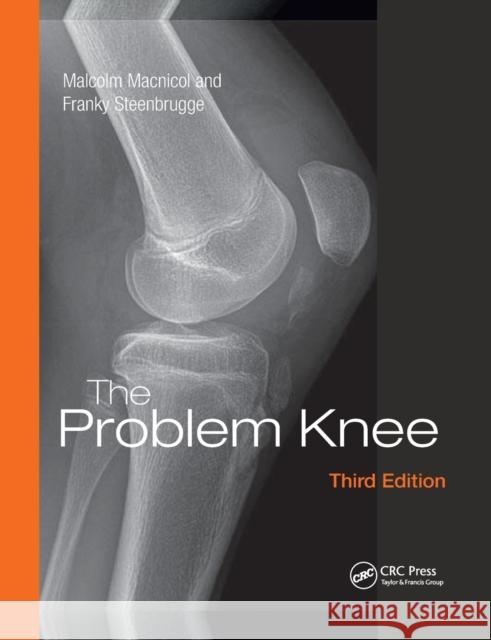 The Problem Knee