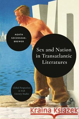 Sex and Nation in Transatlantic Literatures
