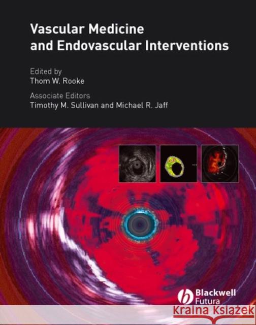 Vascular Medicine and Endovascular Interventions