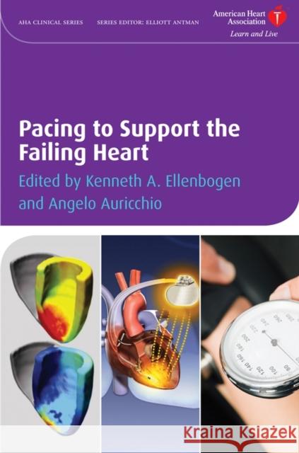 Pacing to Support the Failing Heart