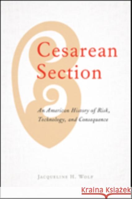 Cesarean Section: An American History of Risk, Technology, and Consequence