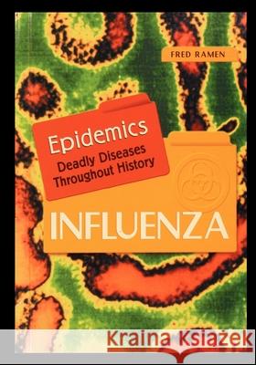 Influenza