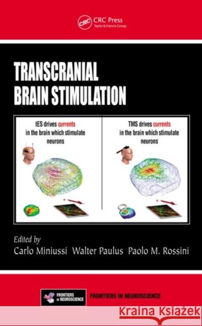 Transcranial Brain Stimulation