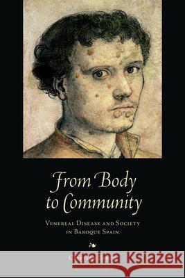 From Body to Community: Venereal Disease and Society in Baroque Spain