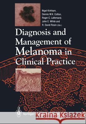 Diagnosis and Management of Melanoma in Clinical Practice