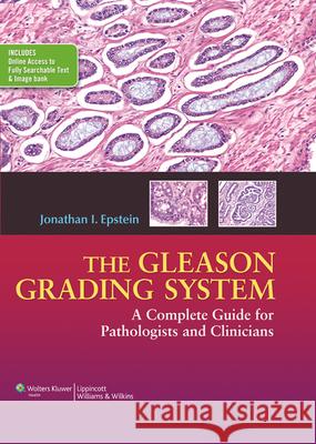 The Gleason Grading System: A Complete Guide for Pathologist and Clinicians