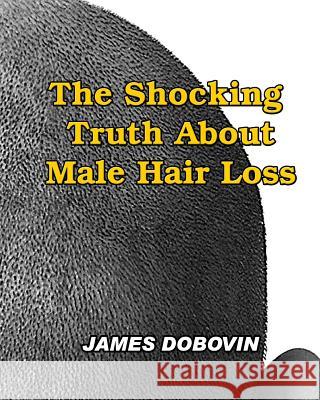 The Shocking Truth About Male Hair Loss: Secrets You Need to Know About Losing Hair So You Can Stop From Going Bald