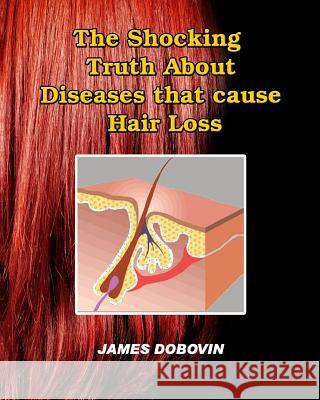 The Shocking Truth About Diseases that Cause Hair Loss: Secrets You Need to Know About Losing Hair So You Can Stop From Going Bald