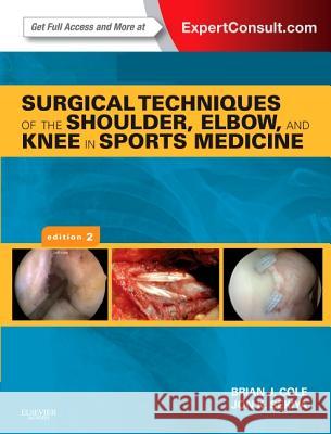 Surgical Techniques of the Shoulder, Elbow, and Knee in Sports Medicine : Expert Consult - Online and Print