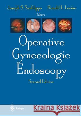 Operative Gynecologic Endoscopy