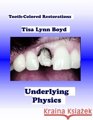 Tooth-Colored Restorations: Underlying Physics