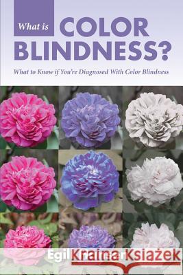 What is Color Blindness?: What to Know if You're Diagnosed With Color Blindness