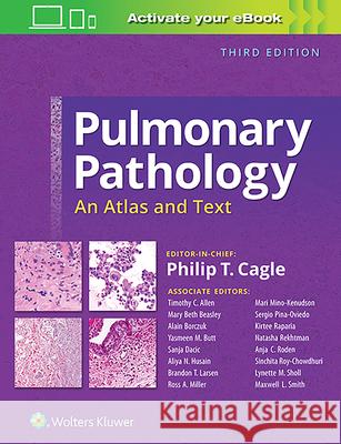 Pulmonary Pathology: An Atlas and Text