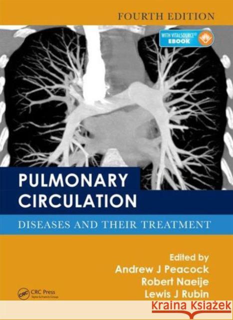 Pulmonary Circulation: Diseases and Their Treatment, Fourth Edition